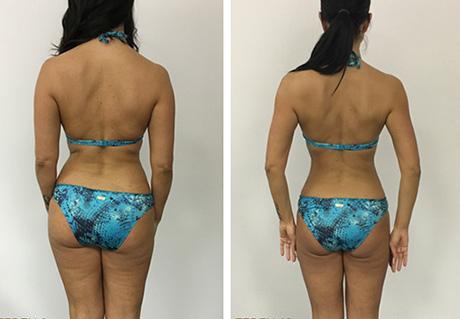 Sibila 
verlor
11 kg